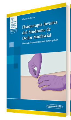 Fisioterapia Invasiva del Síndrome de Dolor Miofascial