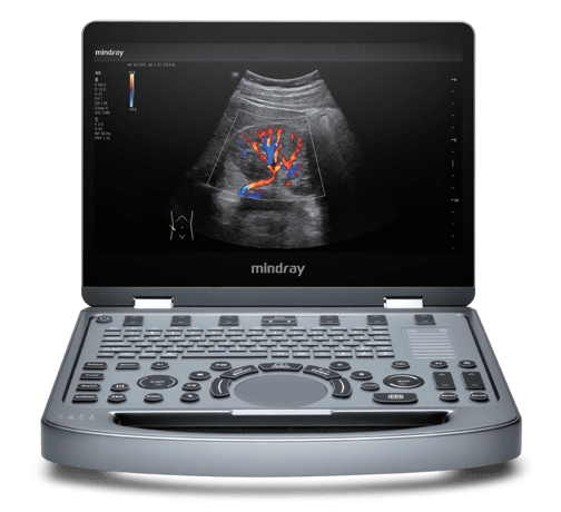 Mindray